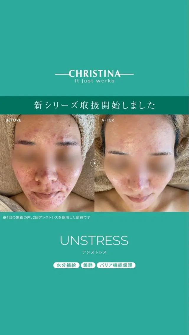 【モニター価格】クリスティーナ アンストレス|肌荒れ・赤み・乾燥ケアの写真