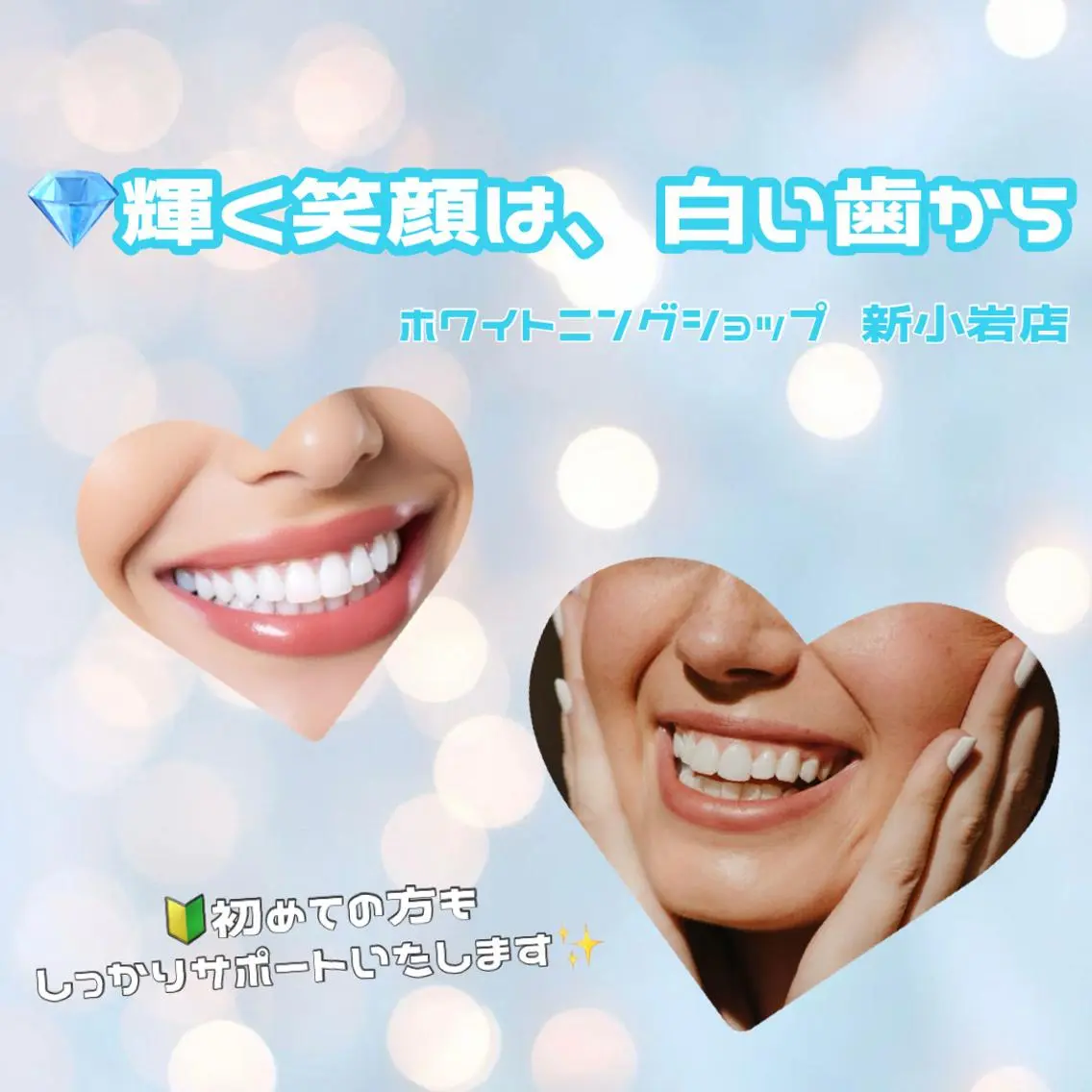 メンズ その他 ホワイトニング ショップ新小岩店のその他イメージ