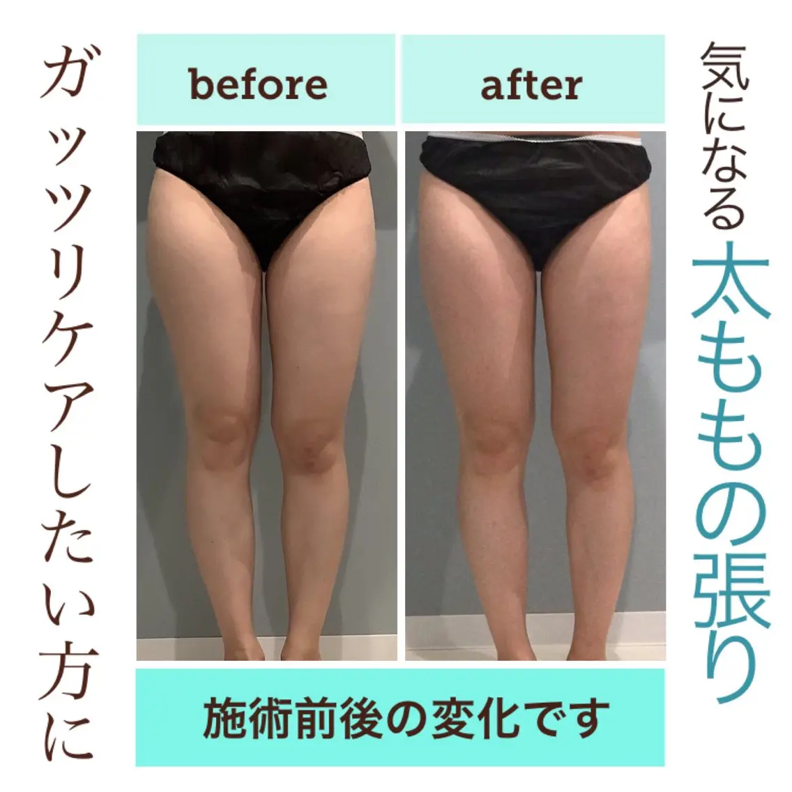 エステ エステサロン JURISのエステ・リラクイメージ