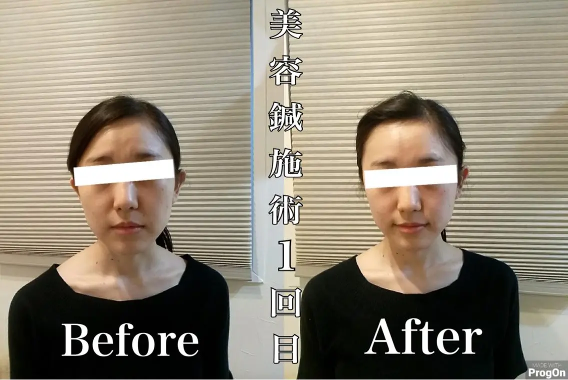 鍼灸 Refineのその他イメージ