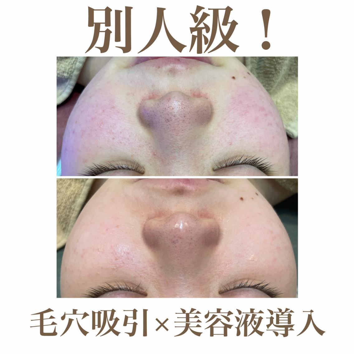 🫧美肌サロン🫧 レイビスひかる🧡のエステ・リラクイメージ