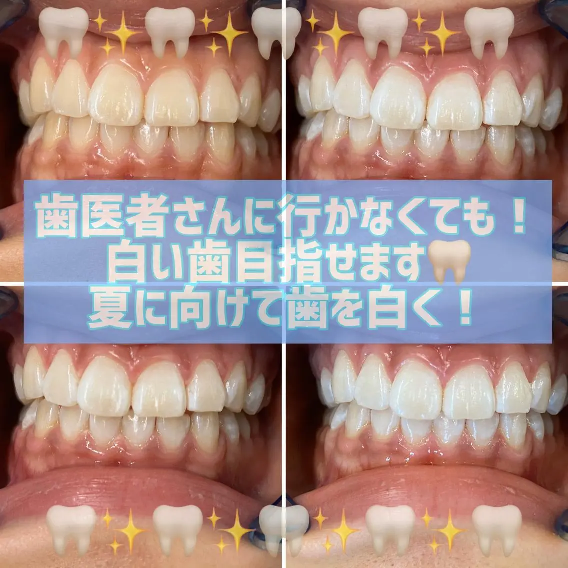 メンズ ネイル マツエク・マツパ ホワイト その他 ホワイトニングサロン CREWのその他イメージ