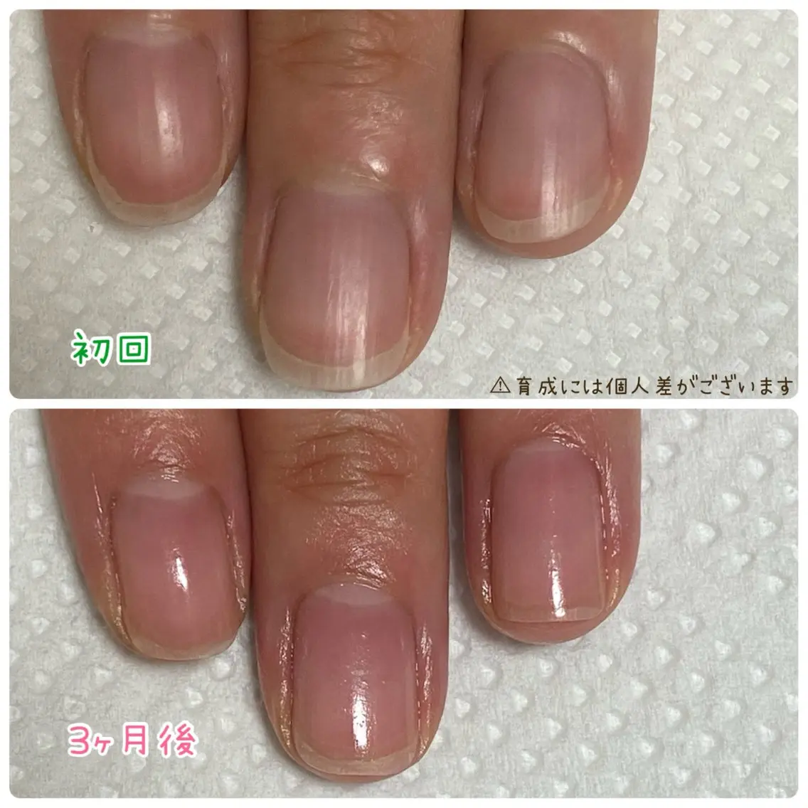 【隠す爪から魅せる爪に✨】育成ケアお試しコース🫶ෆ.*・゚の写真
