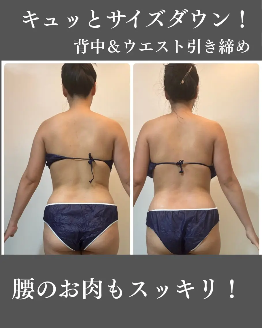オールハンド筋膜痩身 整体/小顔　中山朝美のエステ・リラクイメージ