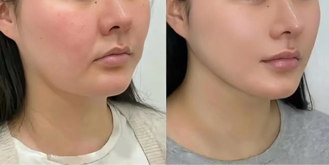 マツエク・マツパ エステ 愛維美水光美肌専門店 メンズレディースokのエステ・リラクイメージ