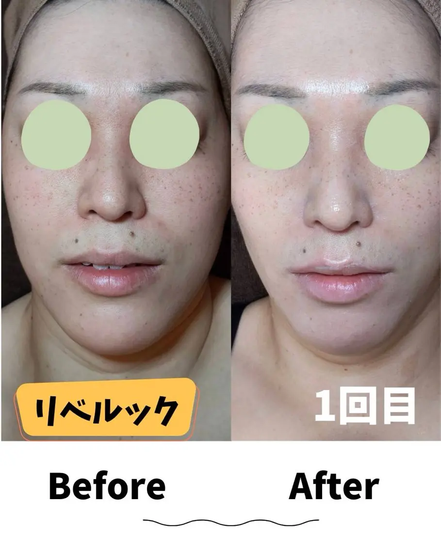 エステ コンセプトサロン友 木下のエステ・リラクイメージ
