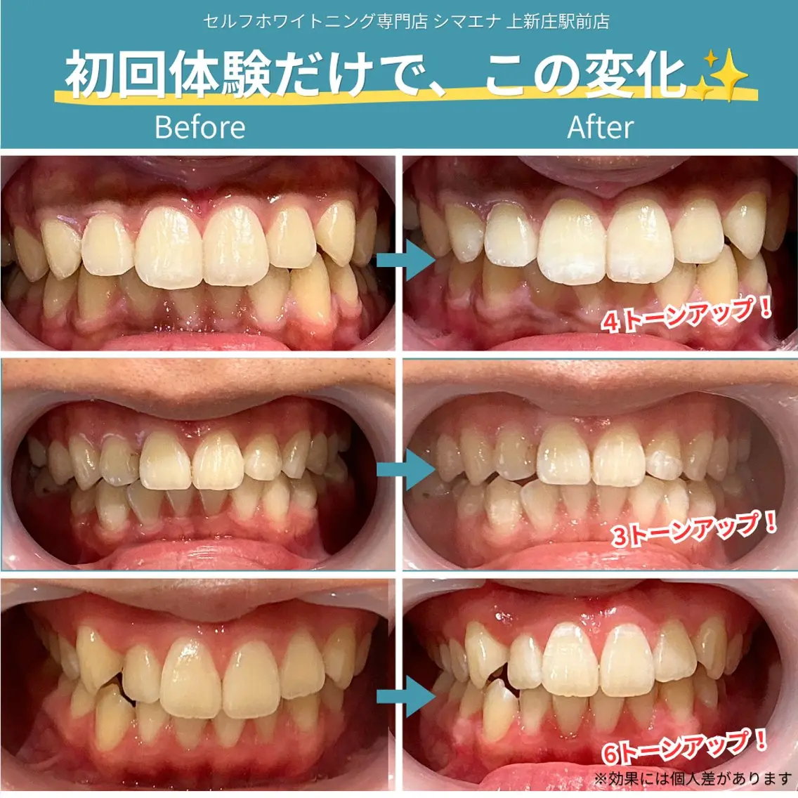 その他 セルフホワイトニング シマエナのその他イメージ