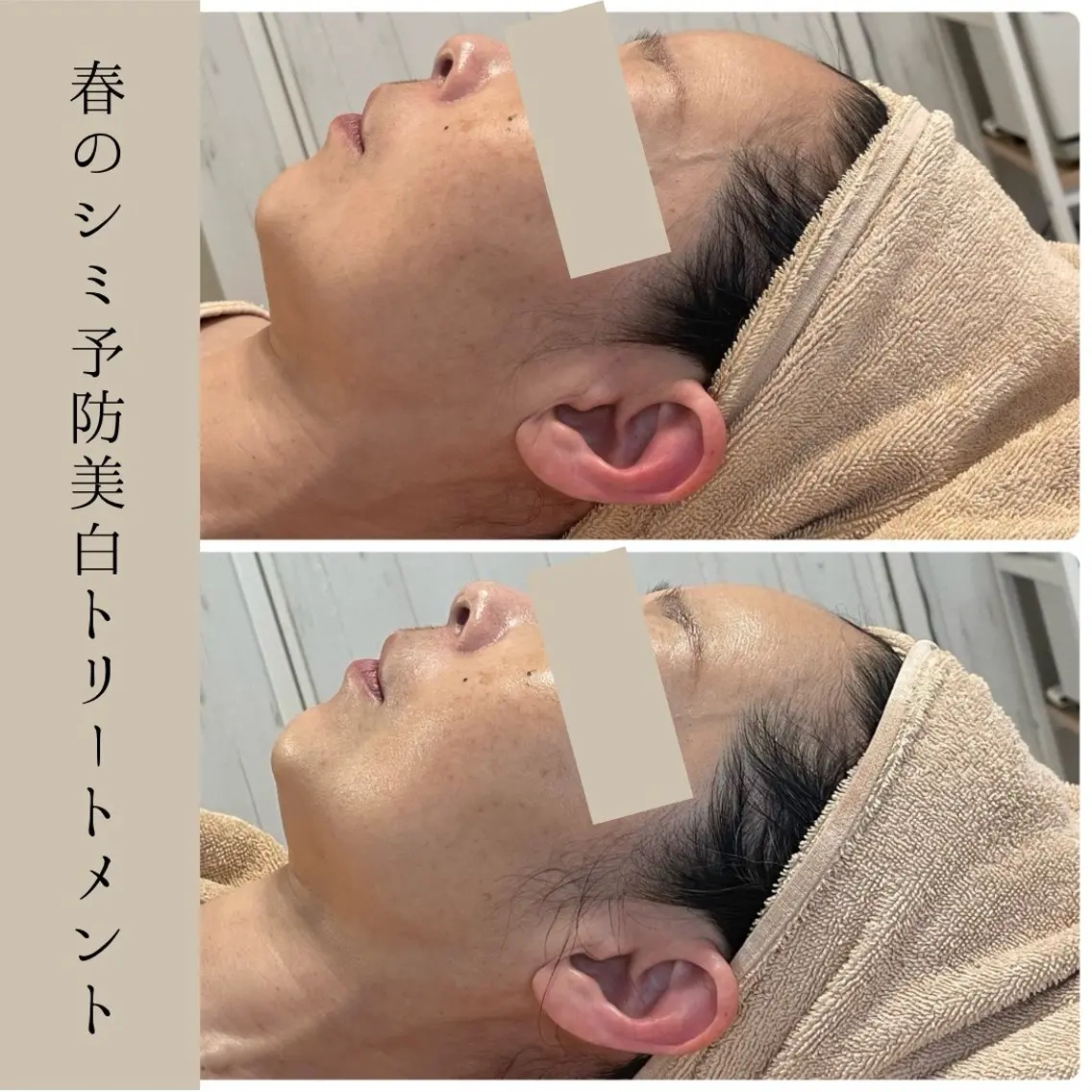 小顔・たるみケア✨ フェイシャル&ボディのエステ・リラクイメージ