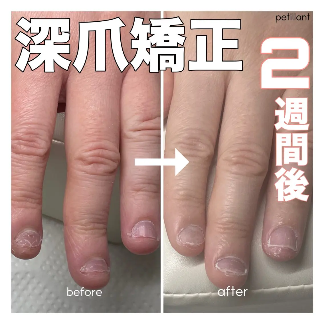 ネイル ジェルネイル nail salon petillantのネイルデザイン