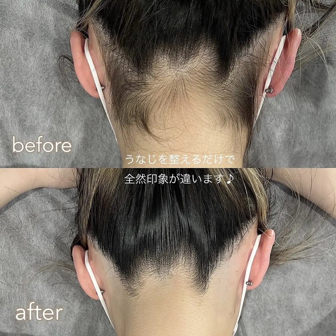 脱毛 脱毛&ホワイトニング ELIXIR×ULTのエステ・リラクイメージ