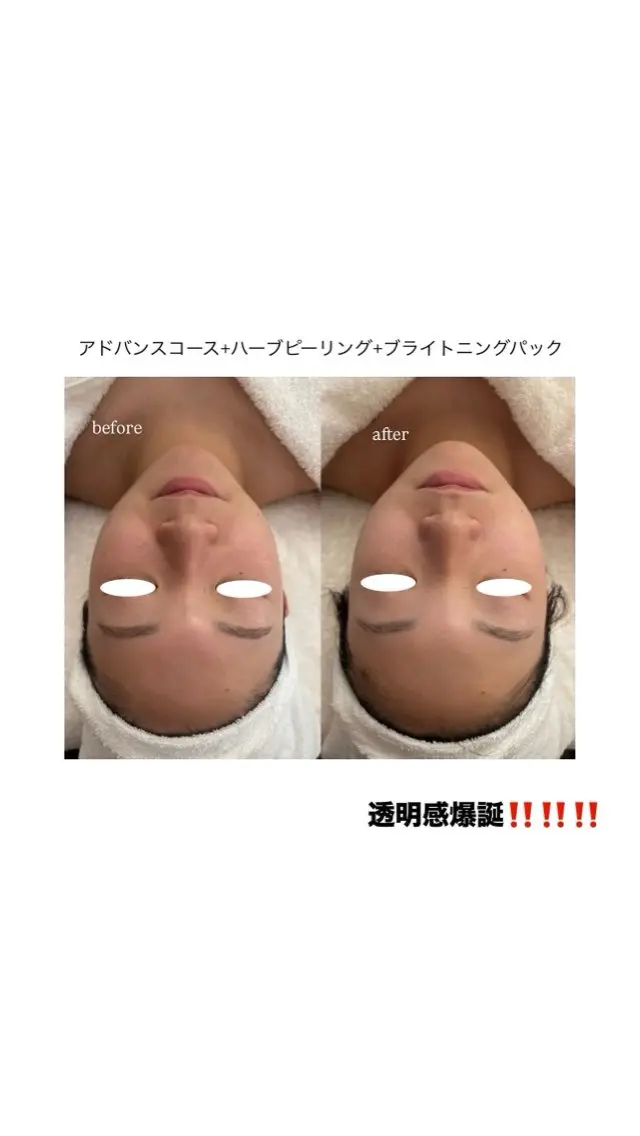 フェイシャルエステ 🎀　naoのエステ・リラクイメージ