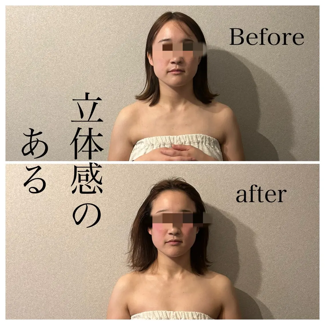 圧倒的たるみ改善 美容鍼エステのエステ・リラクイメージ