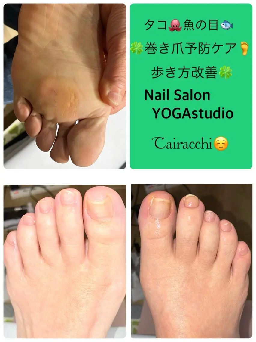 ネイル フットネイル フットネイル Tairacchi タイラッチのエステ・リラクイメージ