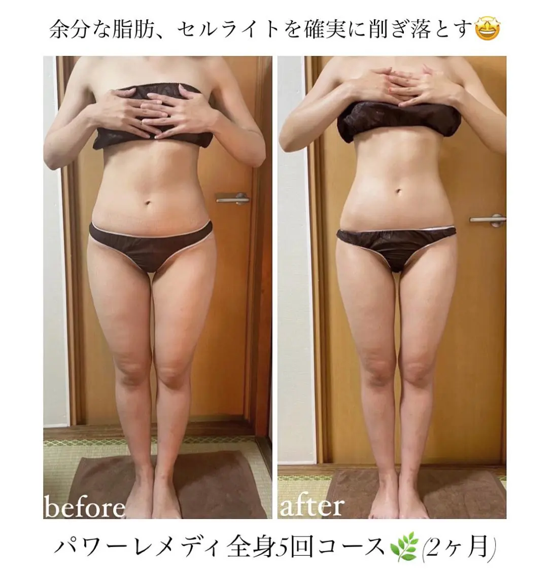 《本気痩せ×疲労改善 》 BILOOPのエステ・リラクイメージ
