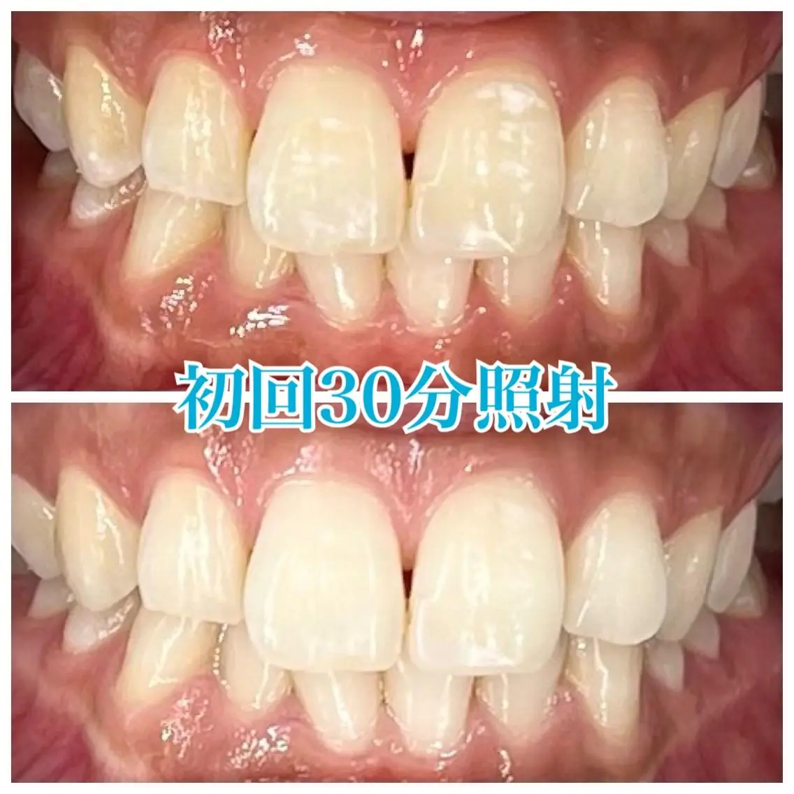 ホワイトニング🦷 ネイル💅LEAのその他イメージ