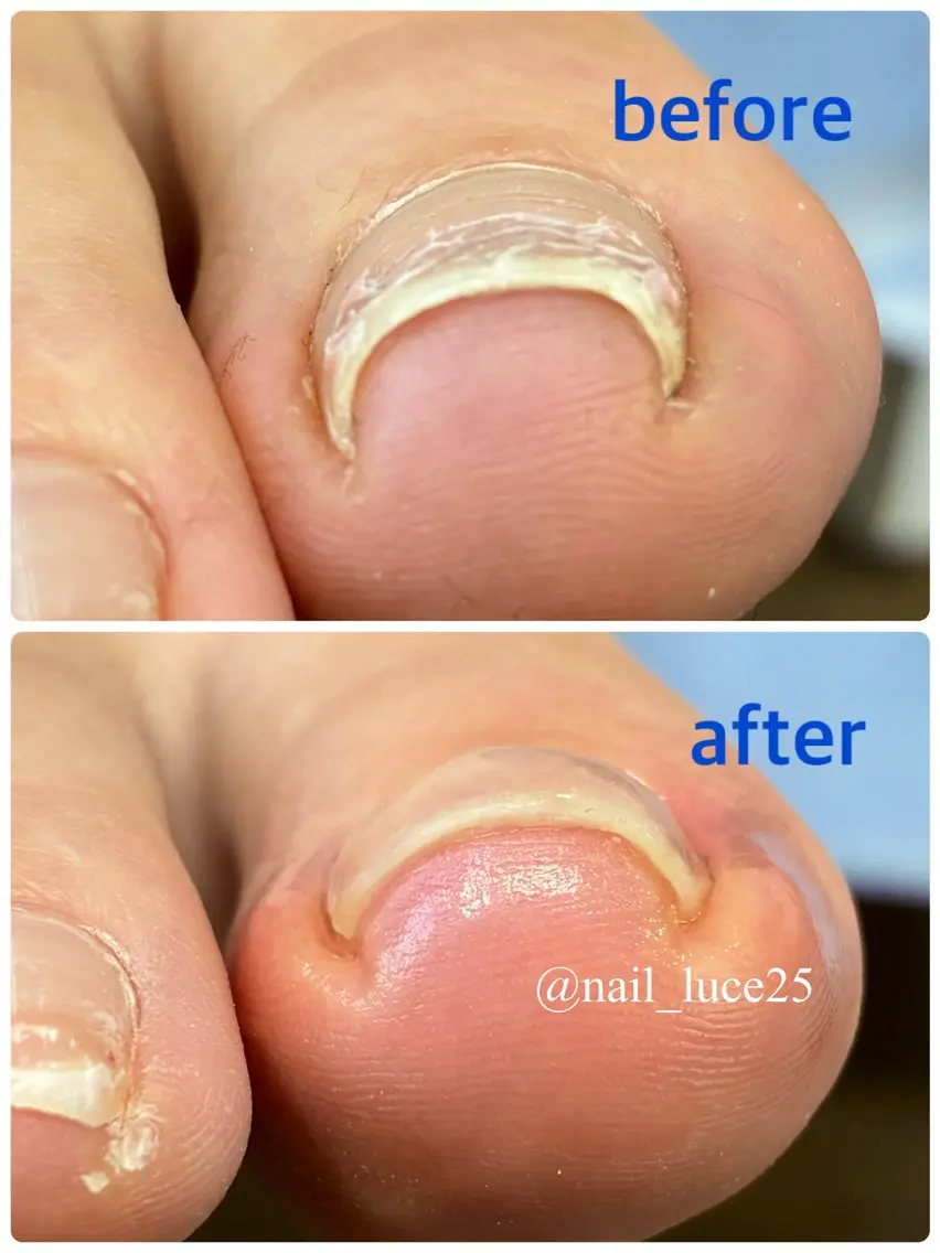 ネイル NAIL Luceのネイルデザイン