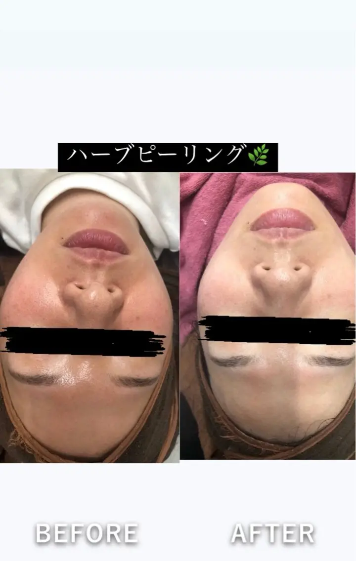 エステ 痩身・脱毛・肌管理 Rechica心斎橋のエステ・リラクイメージ