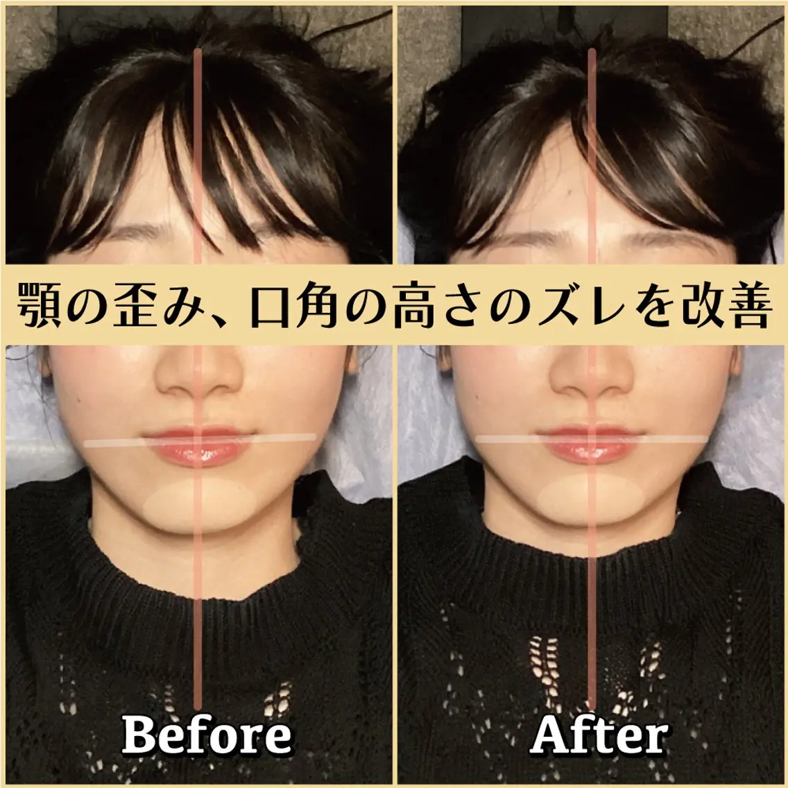 エステ リラク 歪み専門💫筋膜整体 はたやまきんま君💪のエステ・リラクイメージ