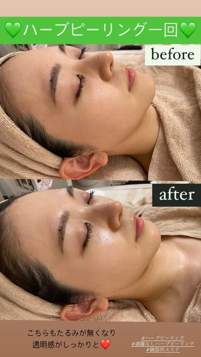 エステ Salon de Lino 御器所のエステ・リラクイメージ
