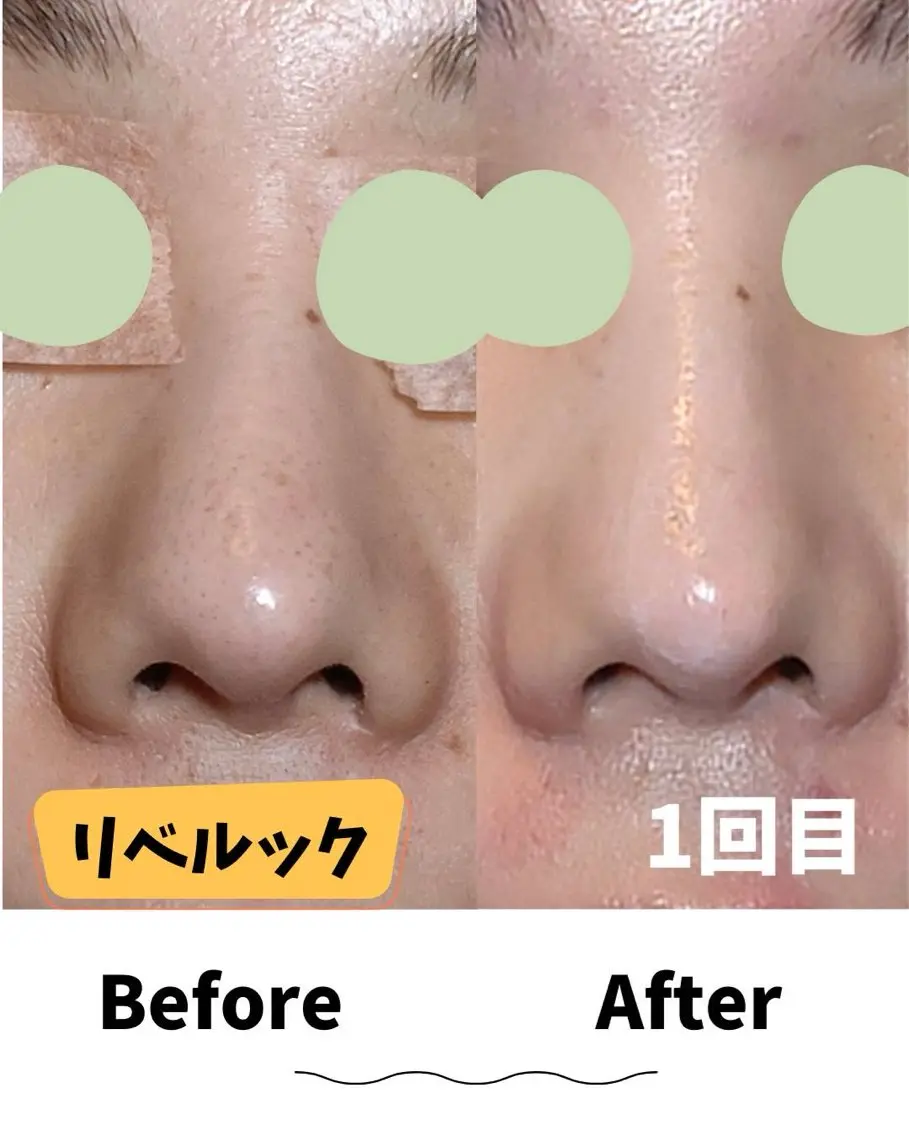エステ コンセプトサロン友 木下のエステ・リラクイメージ