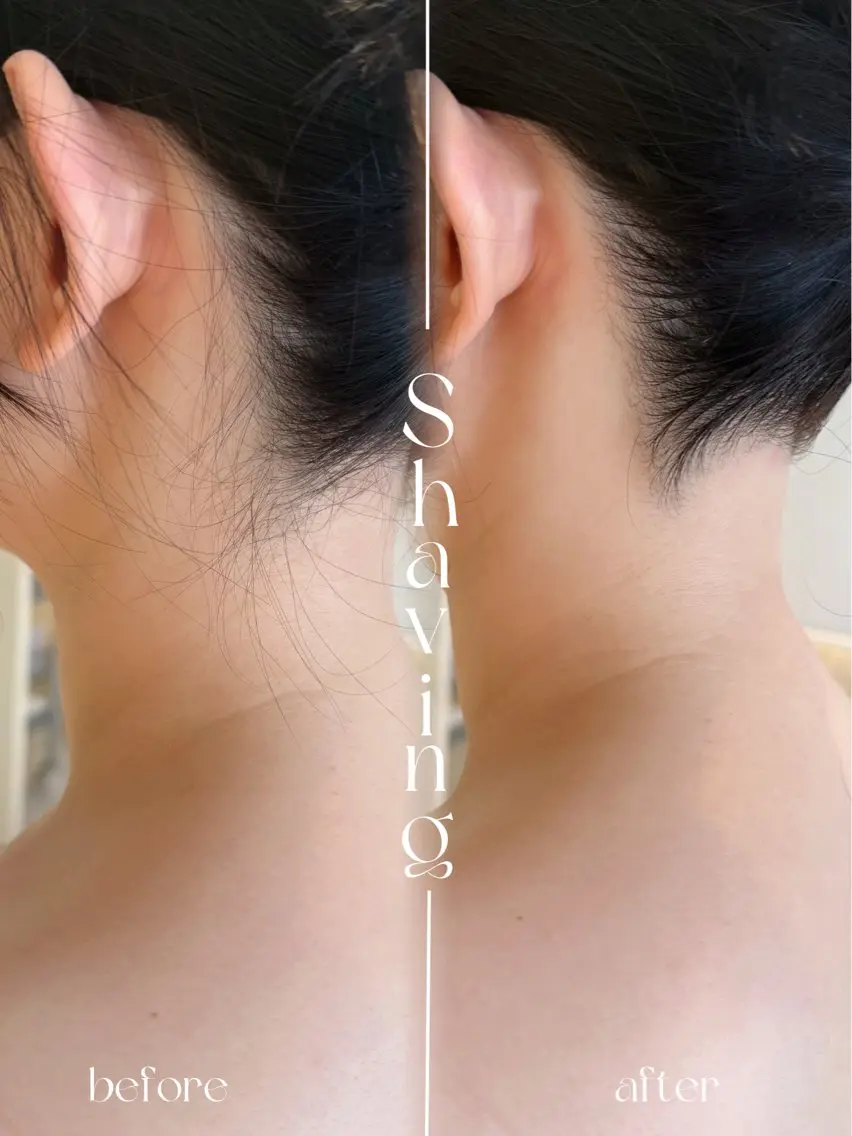 背中上+うなじ シェービング<泡洗顔、ゴマージュ サービス>の写真