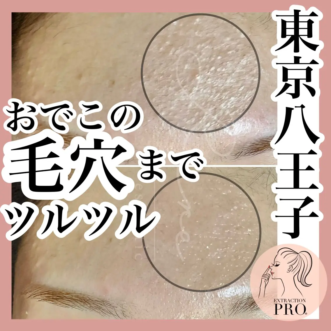 毛穴特化エステ -リールのエステ・リラクイメージ
