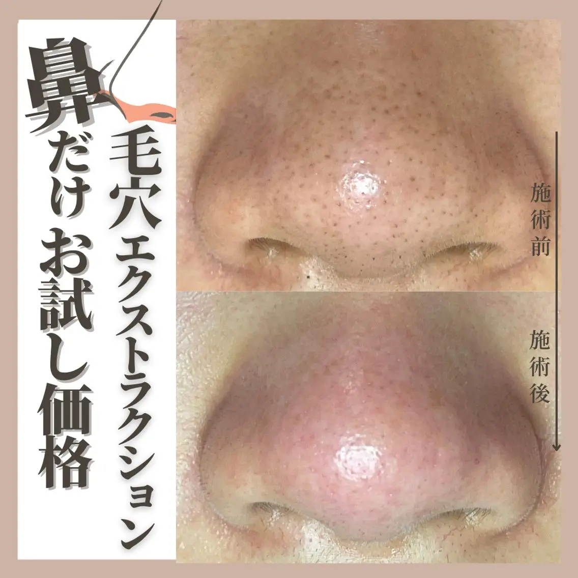 Muqu. 毛穴サロンのエステ・リラクイメージ
