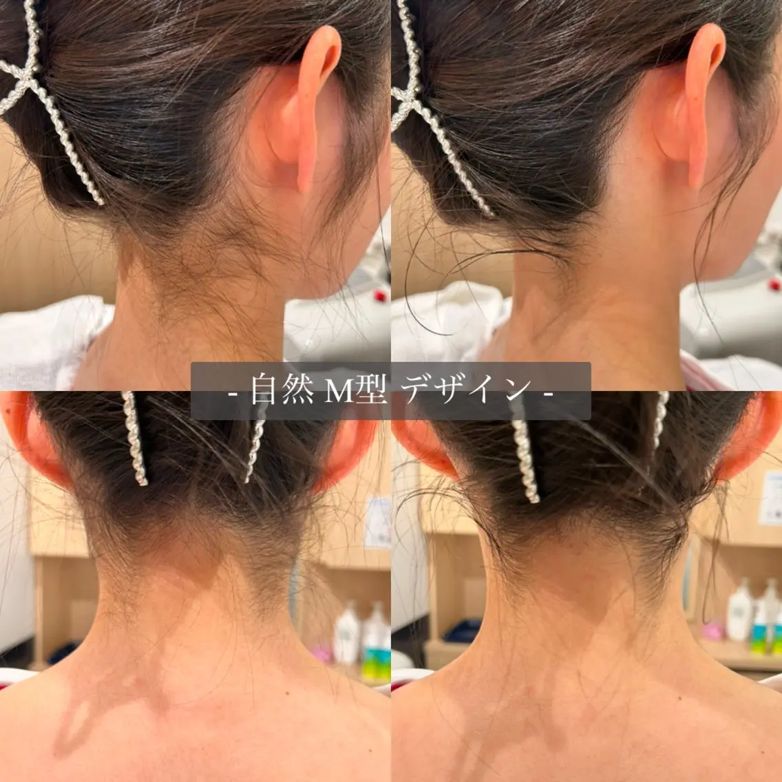 ミストシェービング・うなじ剃りの写真