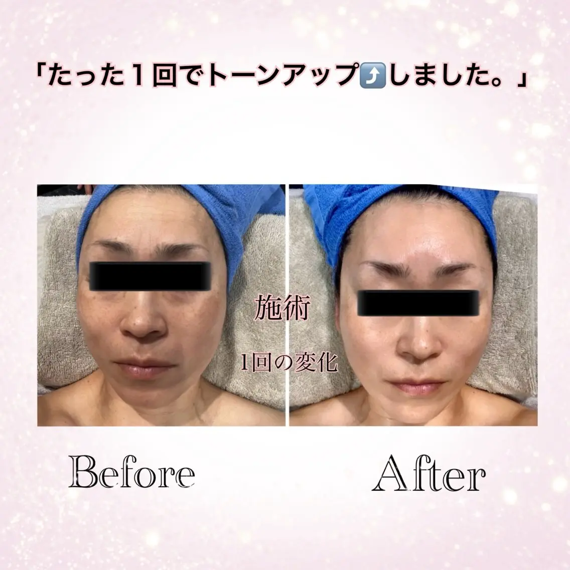 フェイシャルマッサージの写真