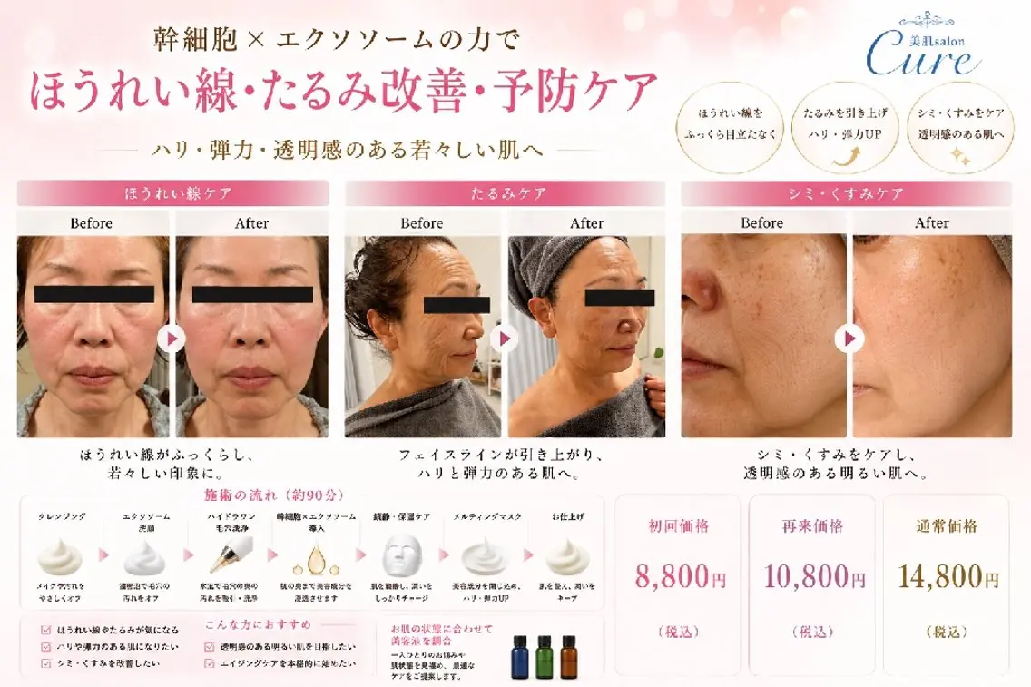 しみ・しわ・くすみ・たるみケア。14800円→8800円の写真