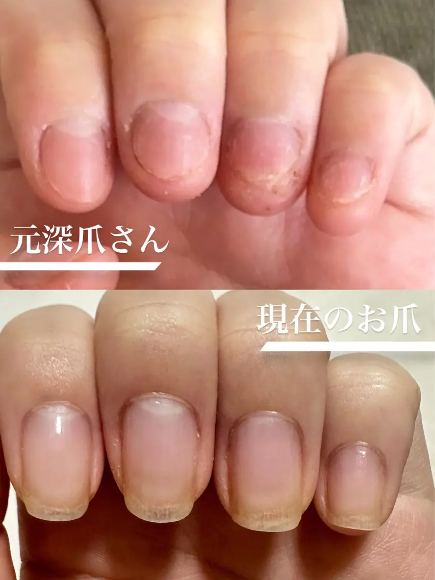 🌿《深爪育成》ハンドケア重視のシンプル仕上げの写真