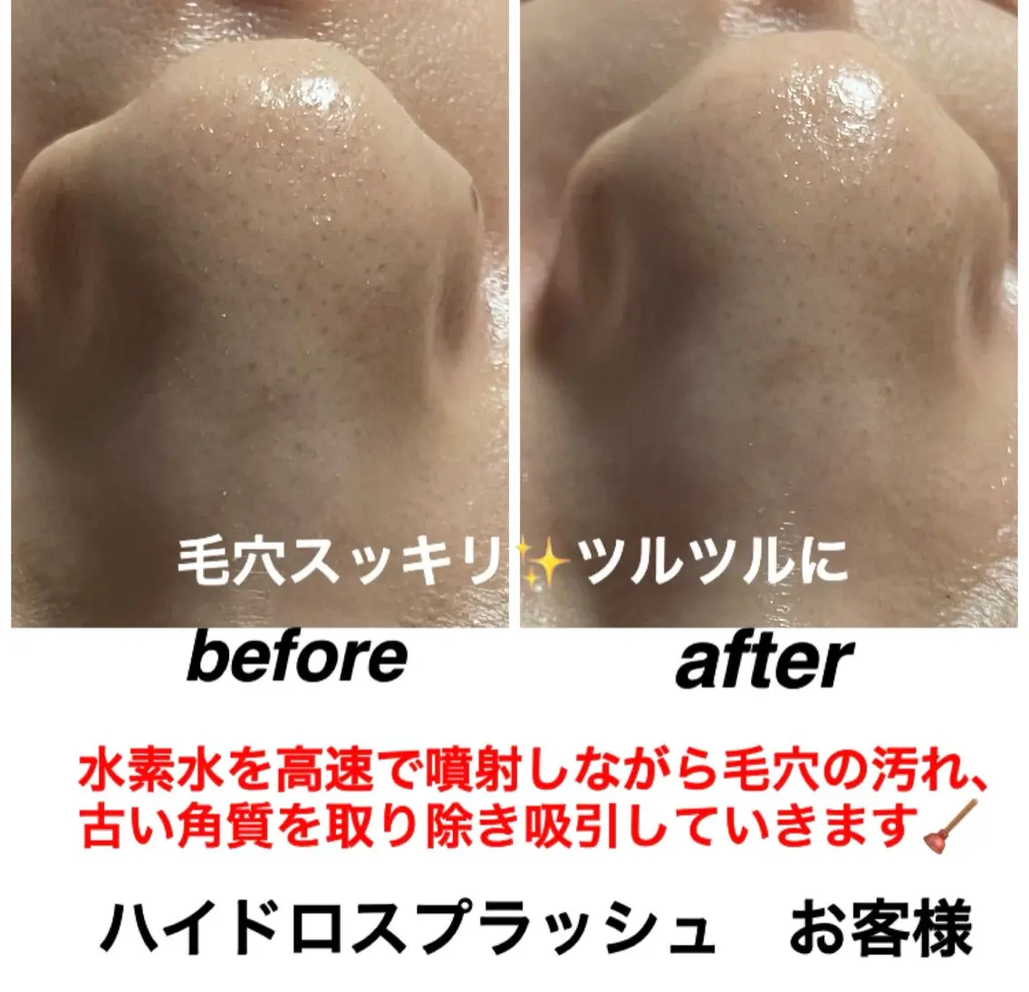 エステ リラク ネイル・エステサロン UILANIのエステ・リラクイメージ