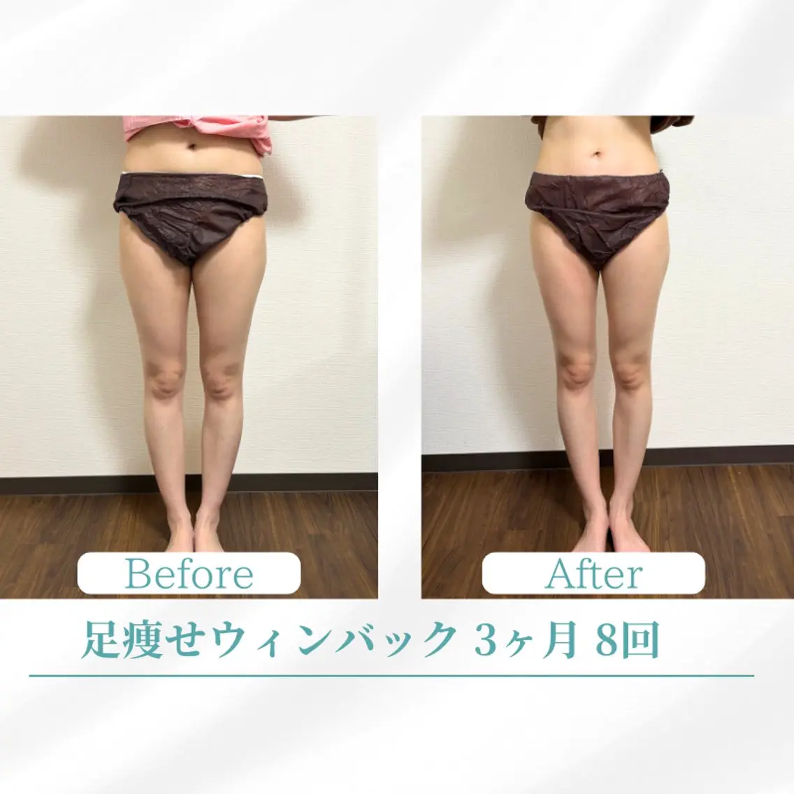 エステ リラク 美容鍼サロン ボディコンディションのエステ・リラクイメージ