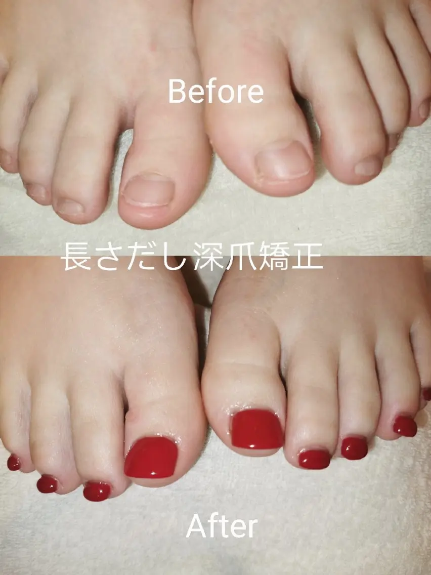 ネイル フットネイル ネイリスト ゆかのネイルデザイン