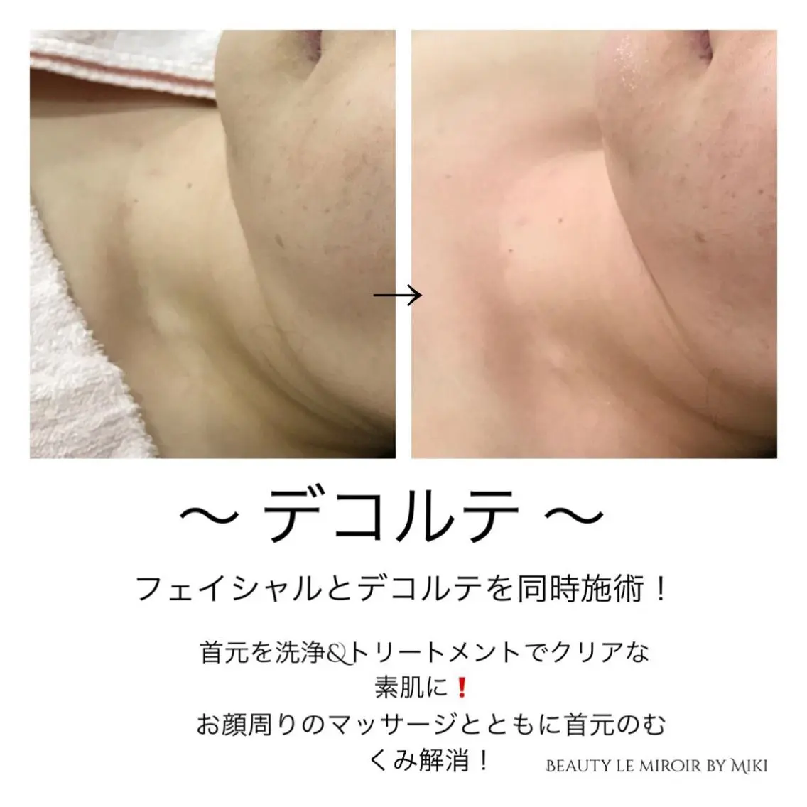 エステ ビューティー ミロワールのエステ・リラクイメージ
