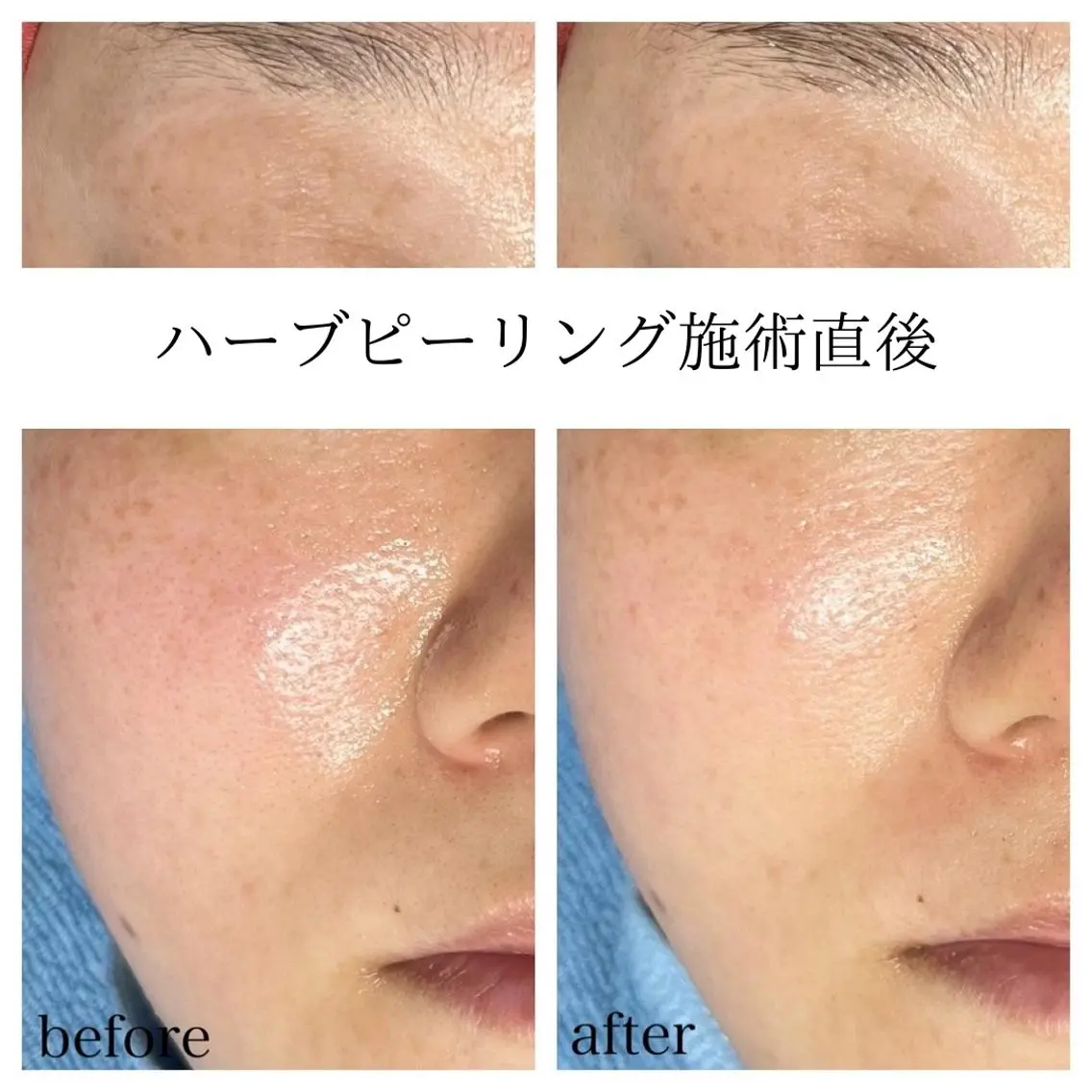エステ Kapua🌺 マユのマツエク・マツパデザイン