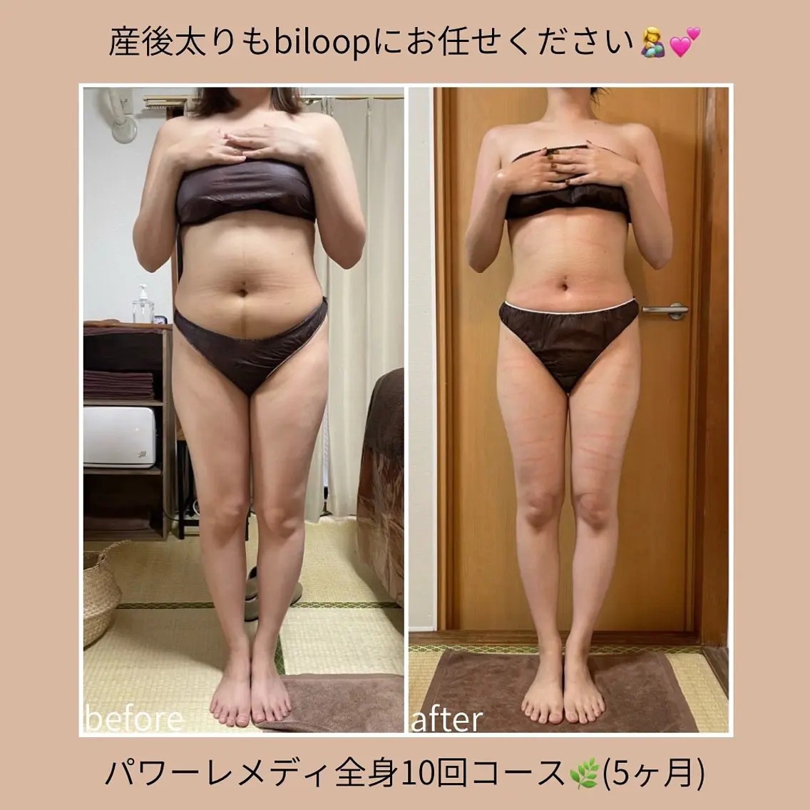 《本気痩せ×疲労改善 》  BILOOPのエステ・リラクイメージ