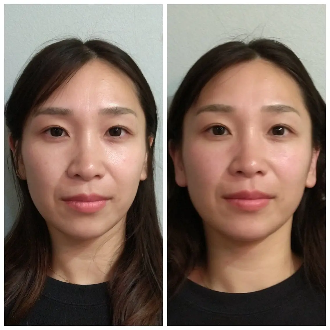 エステ リラク Beauty Salon AQUAのエステ・リラクイメージ