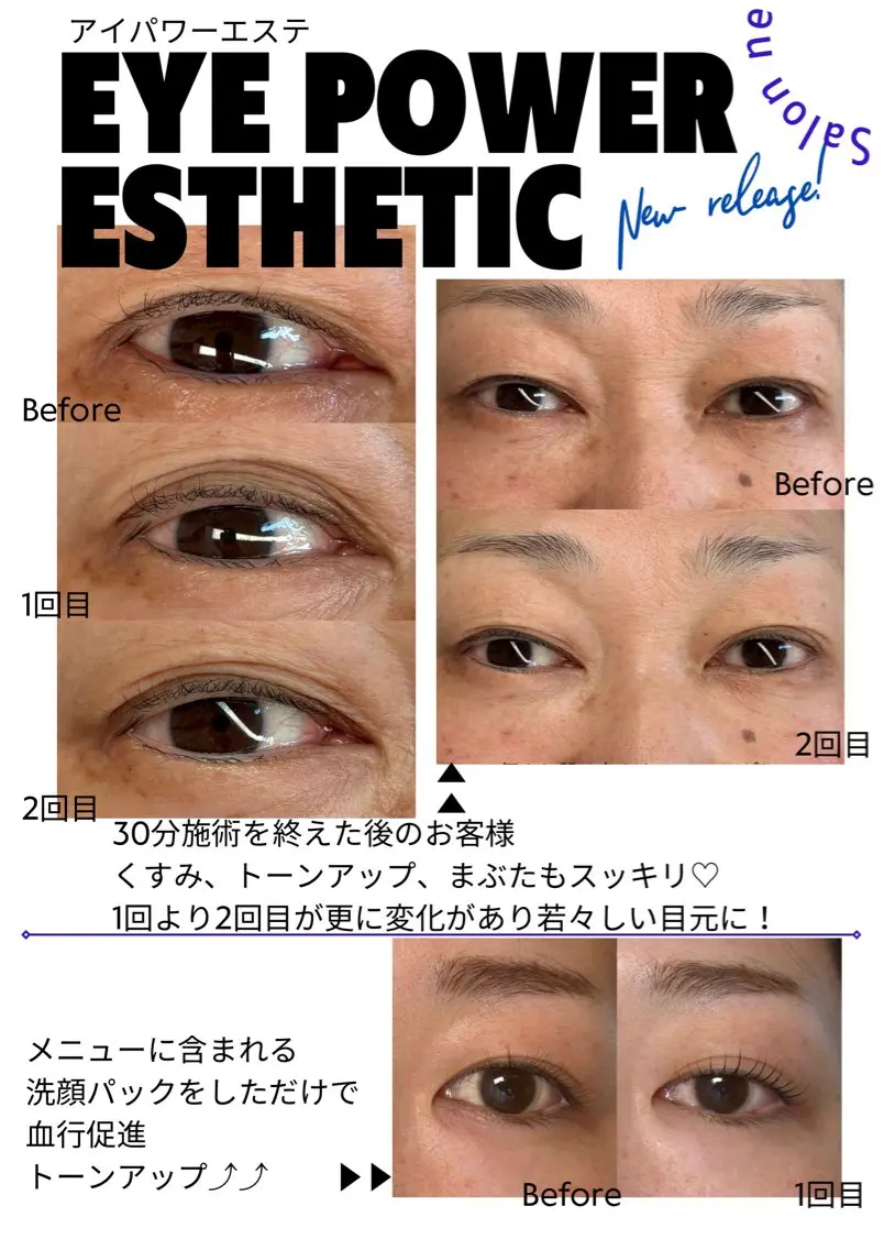 【いつまでも綺麗なまつ毛】アイパワーエステ＋まつ毛パーマ通常17160円▶︎14500円の写真