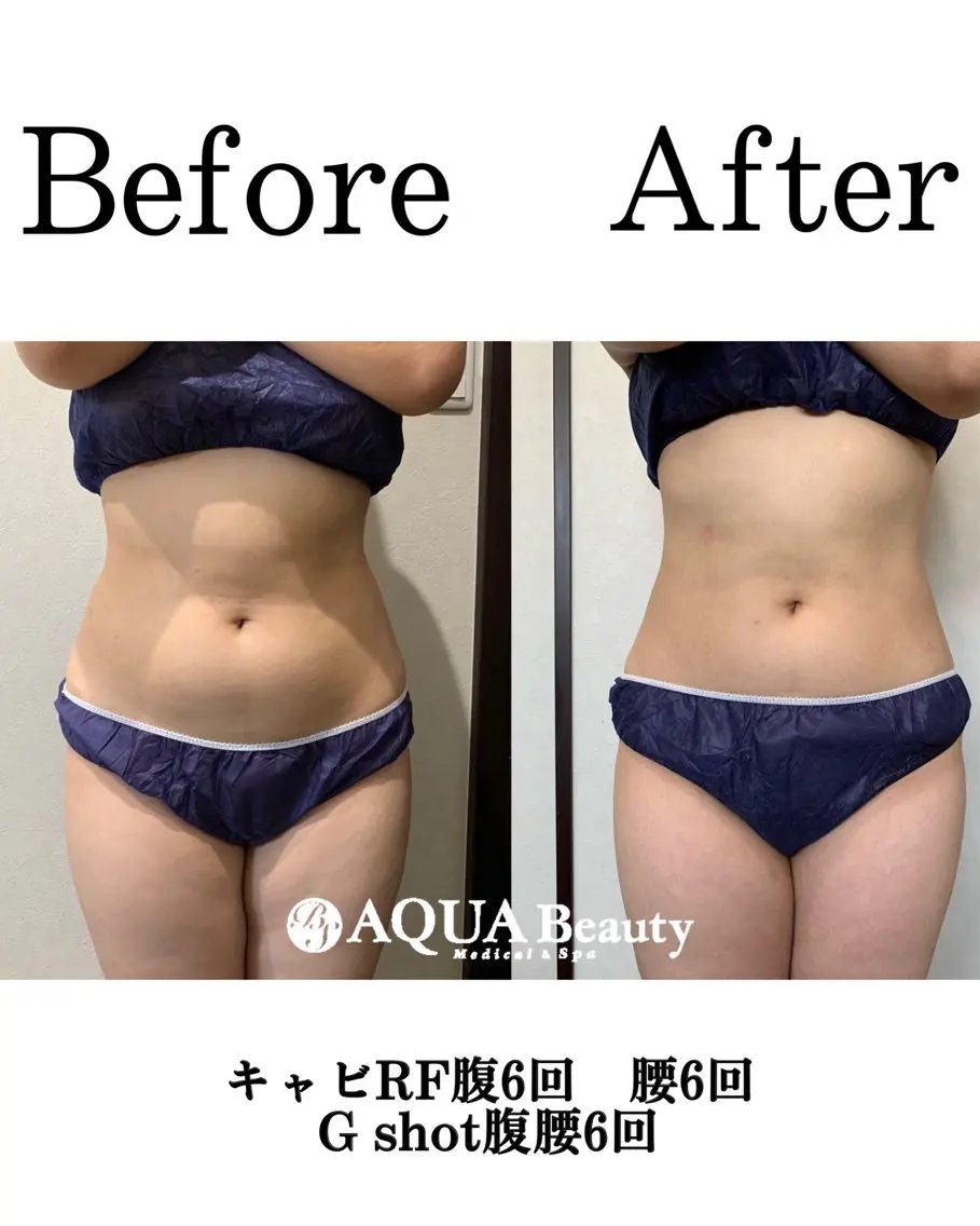 エステ 松島 愛莉のエステ・リラクイメージ
