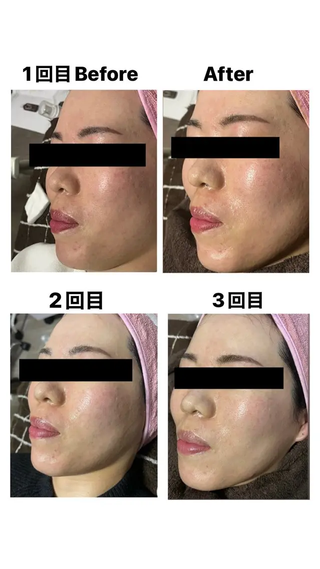 Lash-bar kanoaのエステ・リラクイメージ