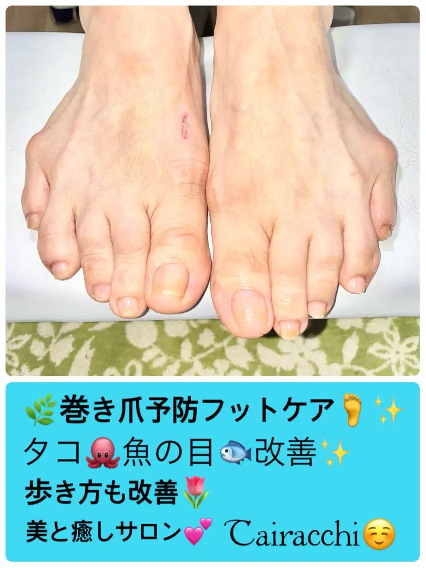 ネイル フットネイル Tairacchi タイラッチのネイルデザイン