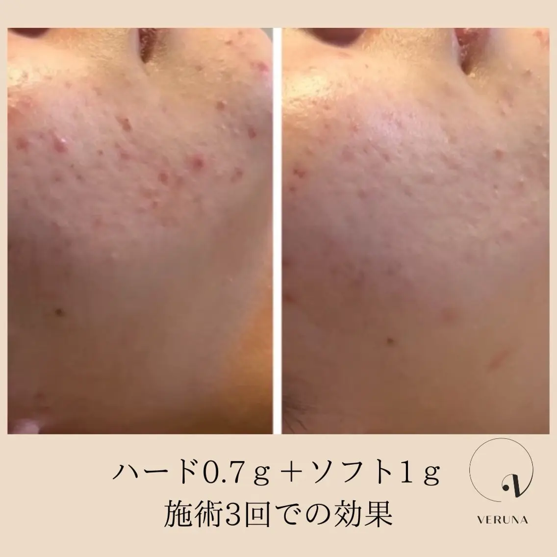 エステ リラク ピーリング専門店 Belluteのエステ・リラクイメージ