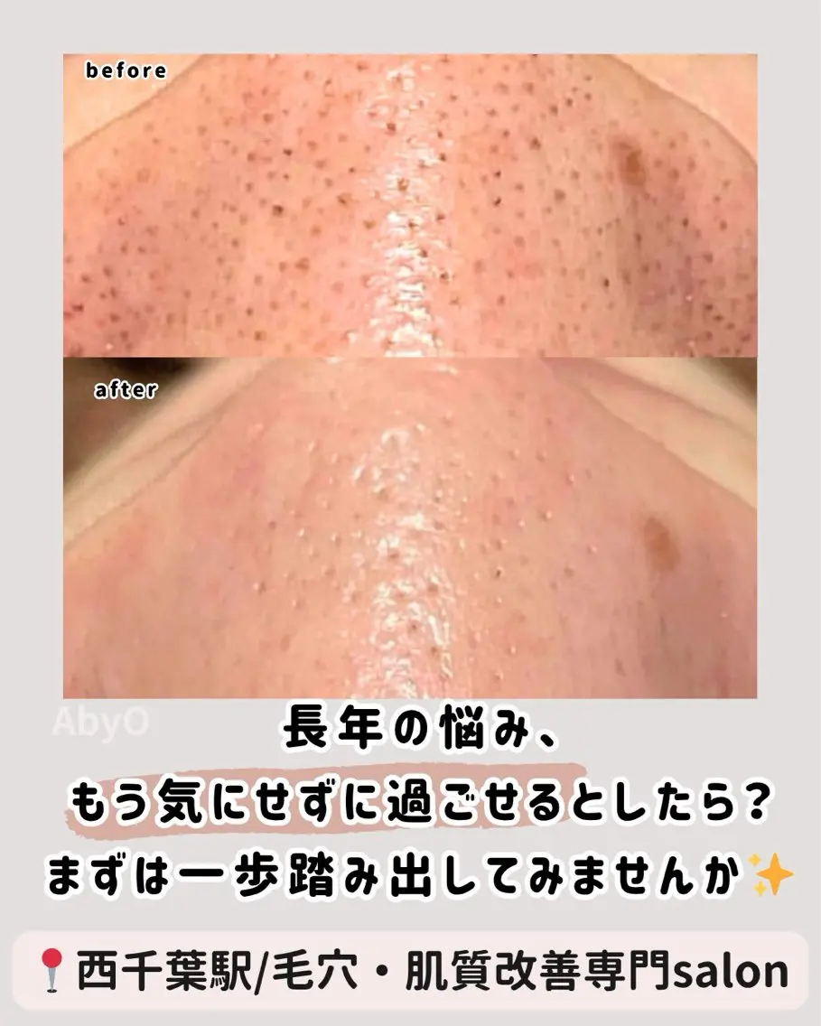 AxO Aestheticのマツエク・マツパデザイン