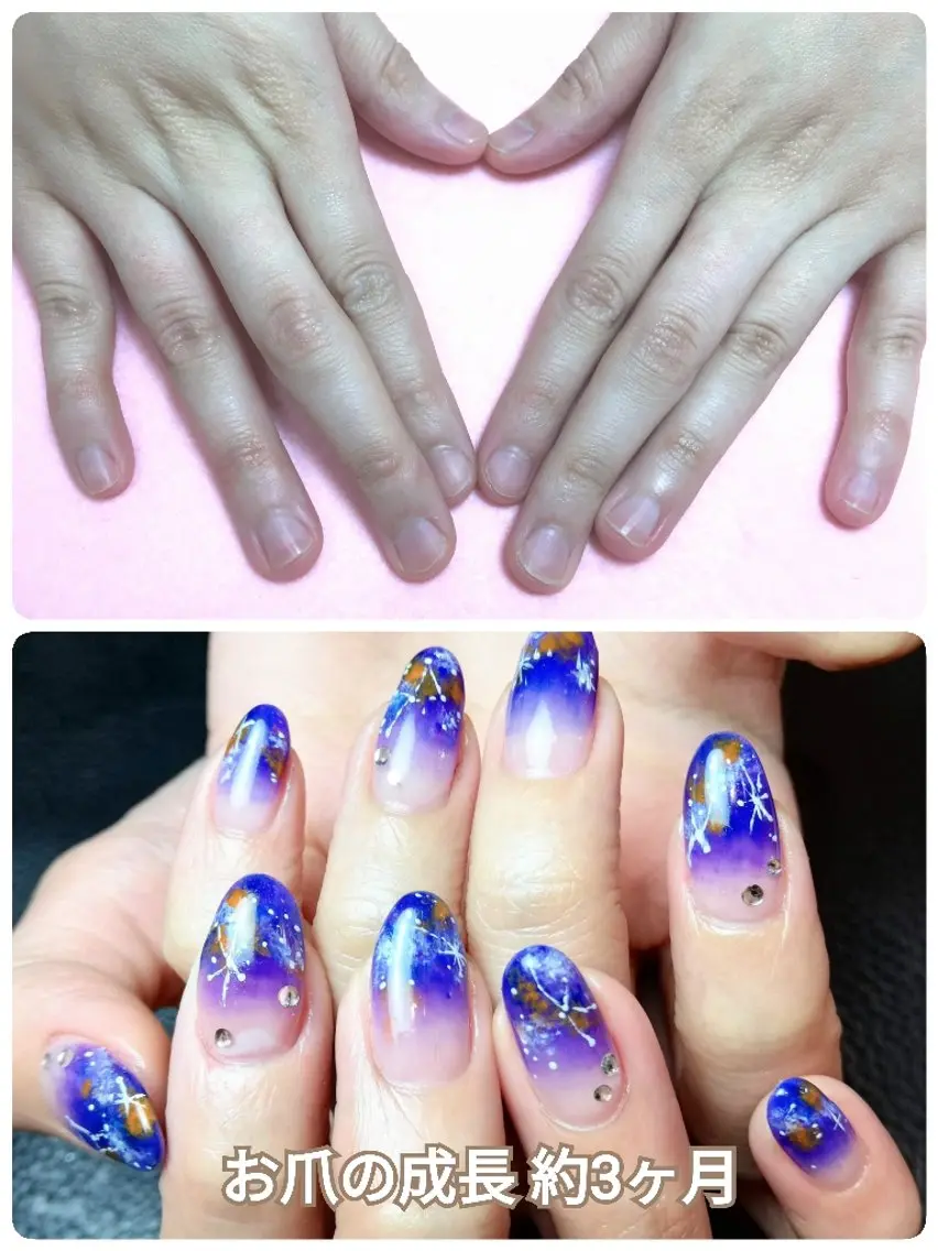 ネイル 深爪矯正/爪育成ケア manie nailのネイルデザイン