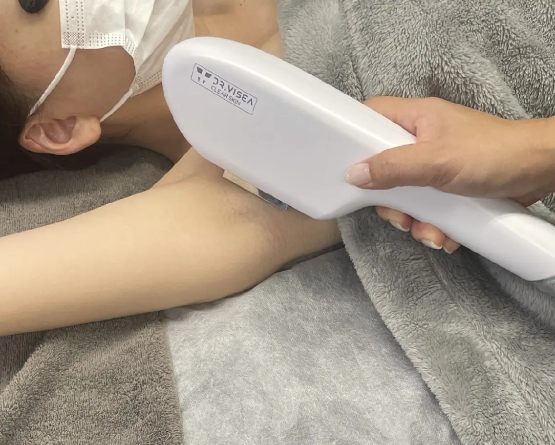 《レディース》脇 脱毛の写真