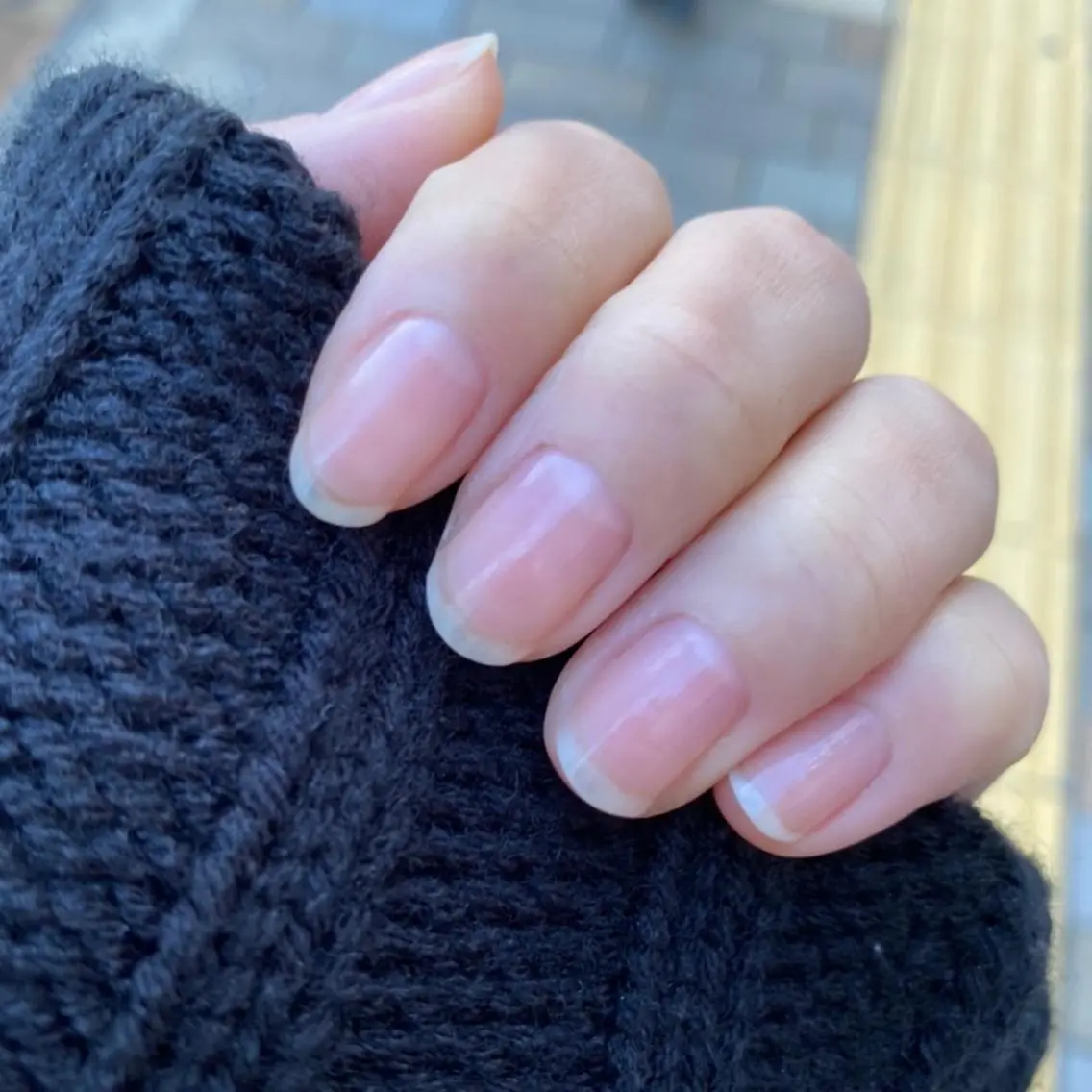 甘皮ケアコースの写真
