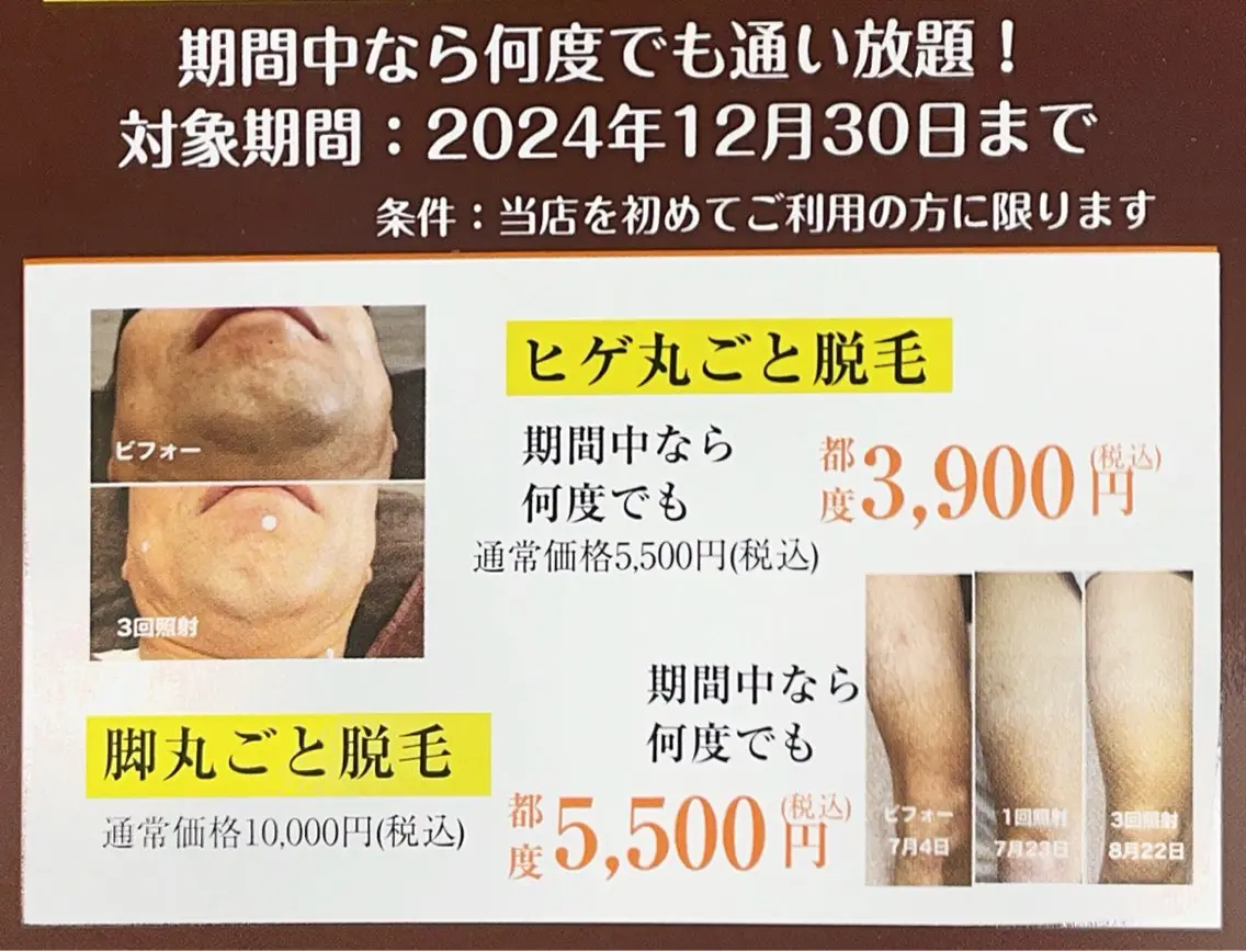 脱毛 脱毛 yukinoのエステ・リラクイメージ