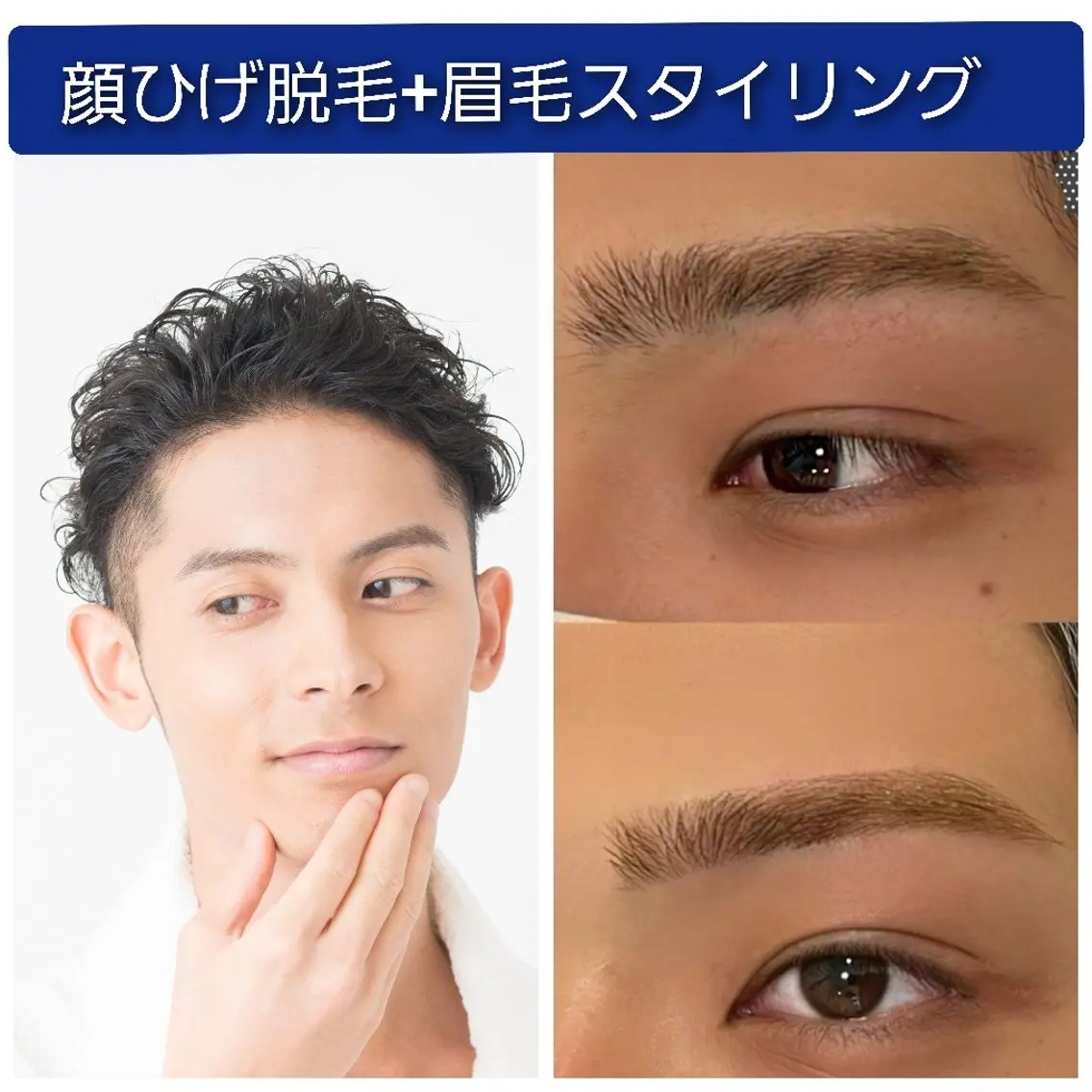 【メンズ】一気に垢抜け☆全顔ひげ脱毛+眉毛スタイリングの写真