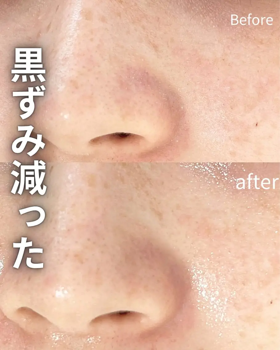 その他 Balance facialのエステ・リラクイメージ
